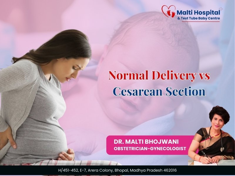 Normal Delivery vs Cesarean Section: Understanding the Difference – Expert Advice by Dr. Malti Bhojwani (40+ Years Experience)