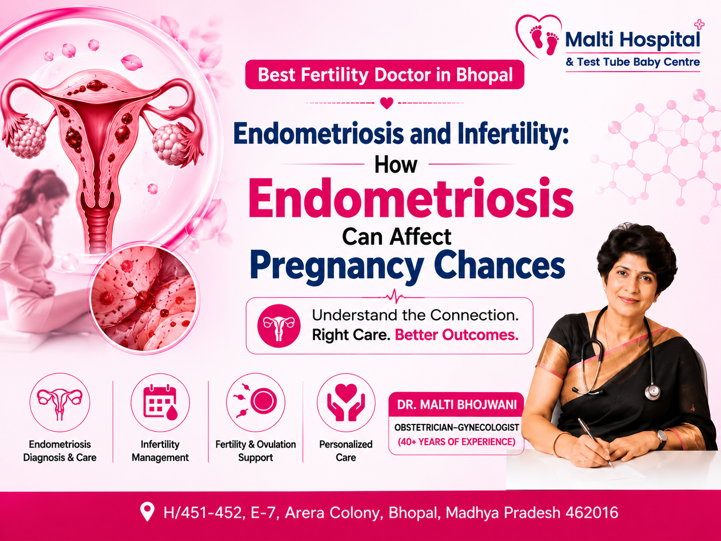 Endometriosis and infertility awareness poster featuring Dr. Malti Bhojwani, fertility care services, and pregnancy guidance in Bhopal